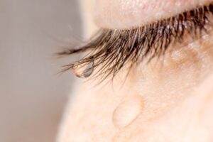 Watery Eyes: Causes and Treatment