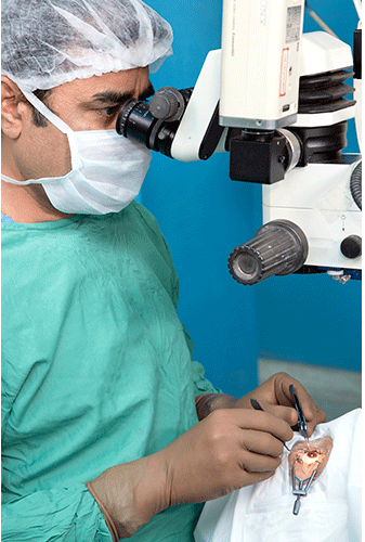 cataract surgery in bangalore
