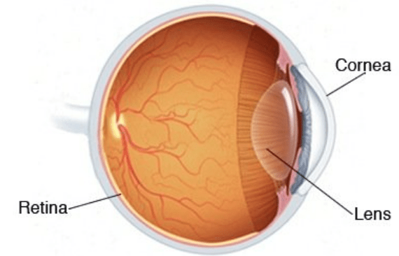 cataract and lasik surgery at same time