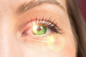 how sunlight can affect your eyes