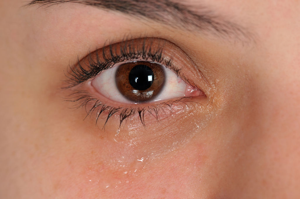 Ephiphora: What Causes Teary Eyes?