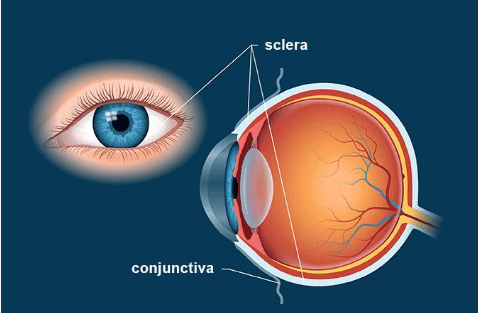 Sclera